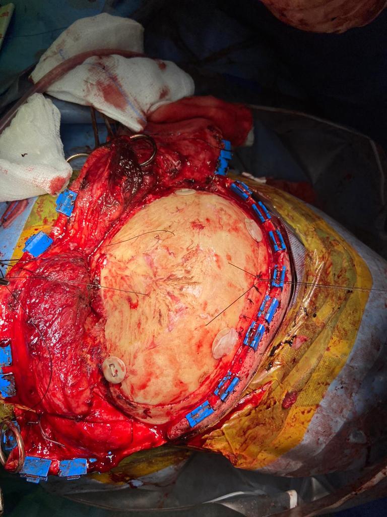 NTCRANIAL clinical application image 04
